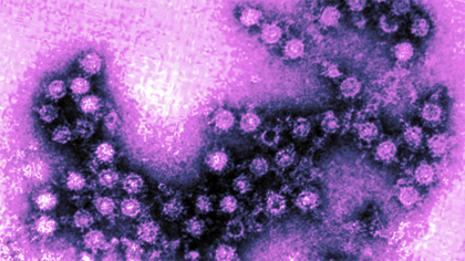 Enterovirus (Departament de Salut)
