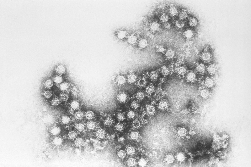 Enterovirus (Wikipedia Commons)